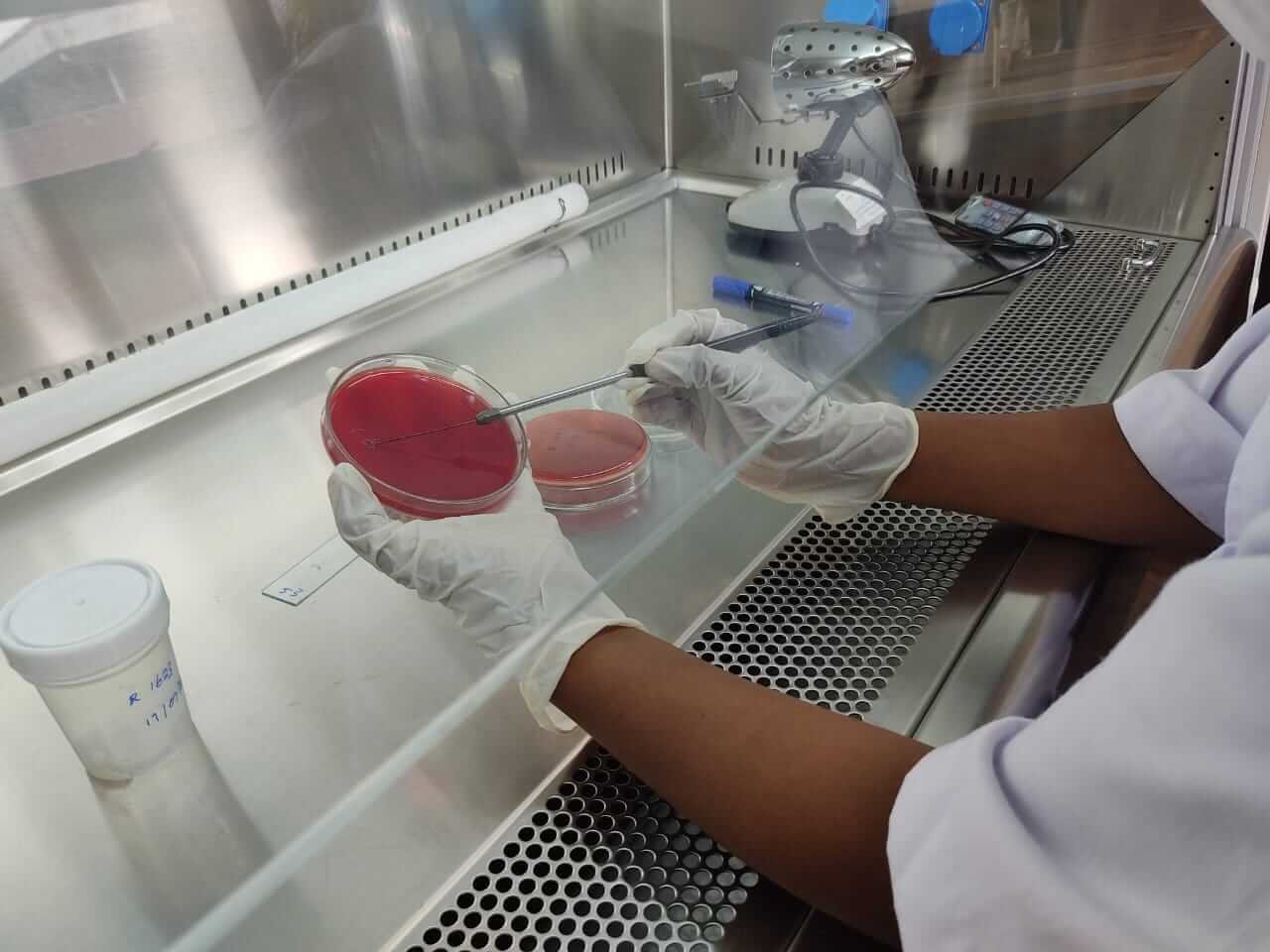 Epidemiology, Treatment Regimens, and Outcomes of Infections due to Carbapenem-Resistant Organisms in Three Hospitals in Southern  Sri Lanka: A Mixed-Methods Study.